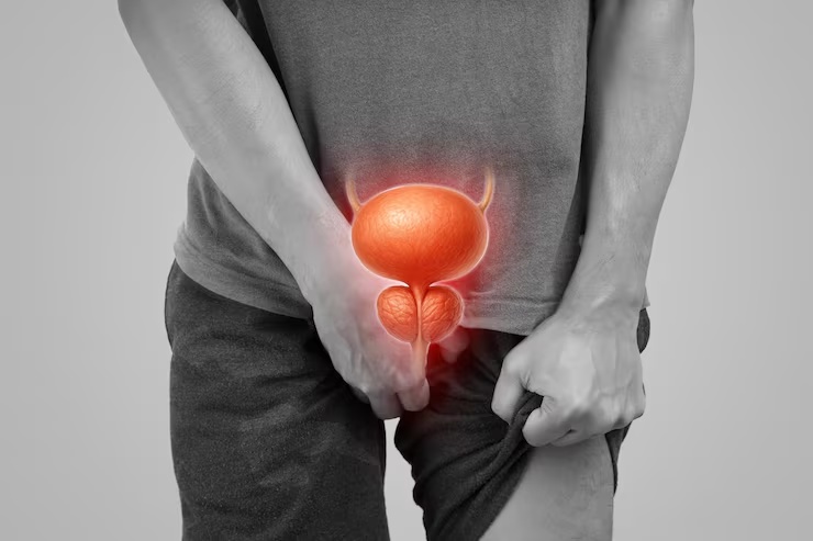 Men's Prostate Health